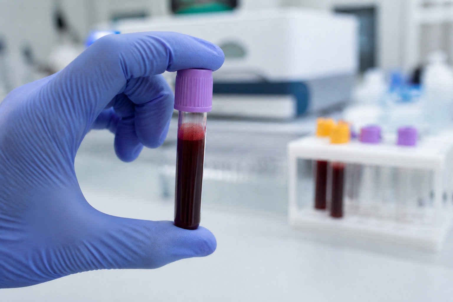 Test urinaire ou sanguin : quel est le timing parfait ? ⏳